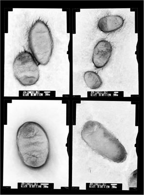 A Wohlfahrtiimonas chitiniclastica with a novel type of blaVEB–1-carrying plasmid isolated from a zebra in China